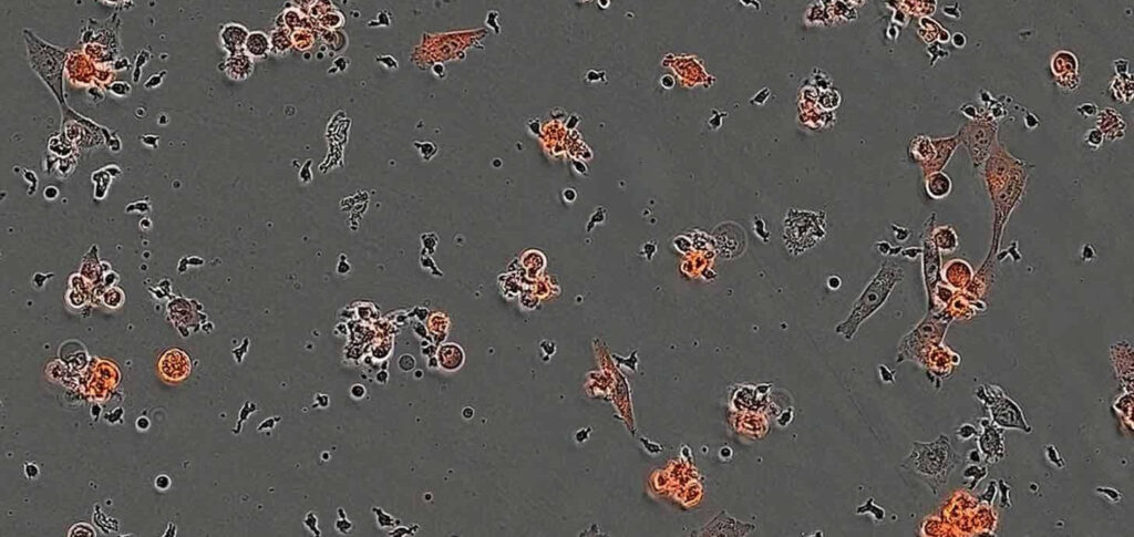 IA cria proteínas que combatem o câncer em semanas